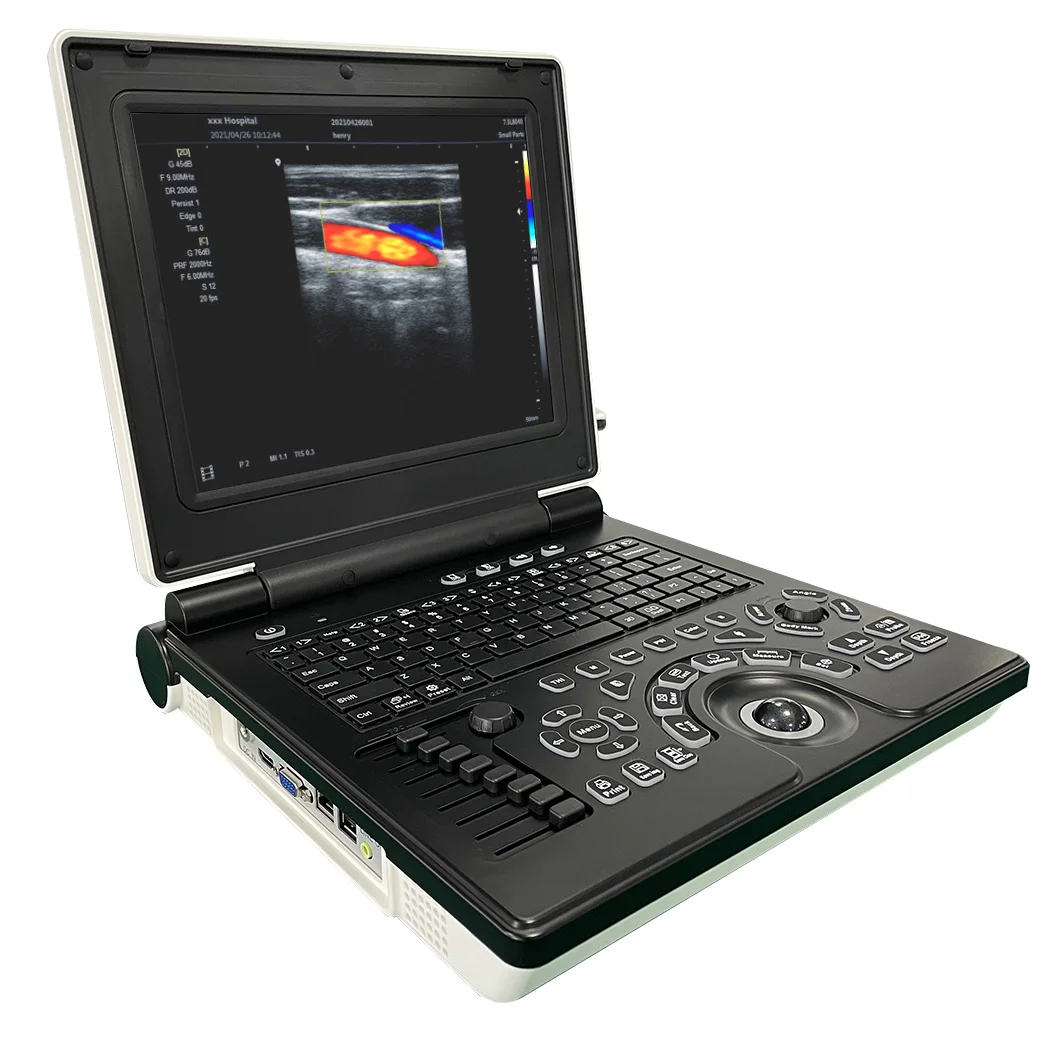 HUC-180 Full Digital 3d Laptop Color Doppler Ultrasound Diagnostic System Portable Ultrasonography Machine with Printer