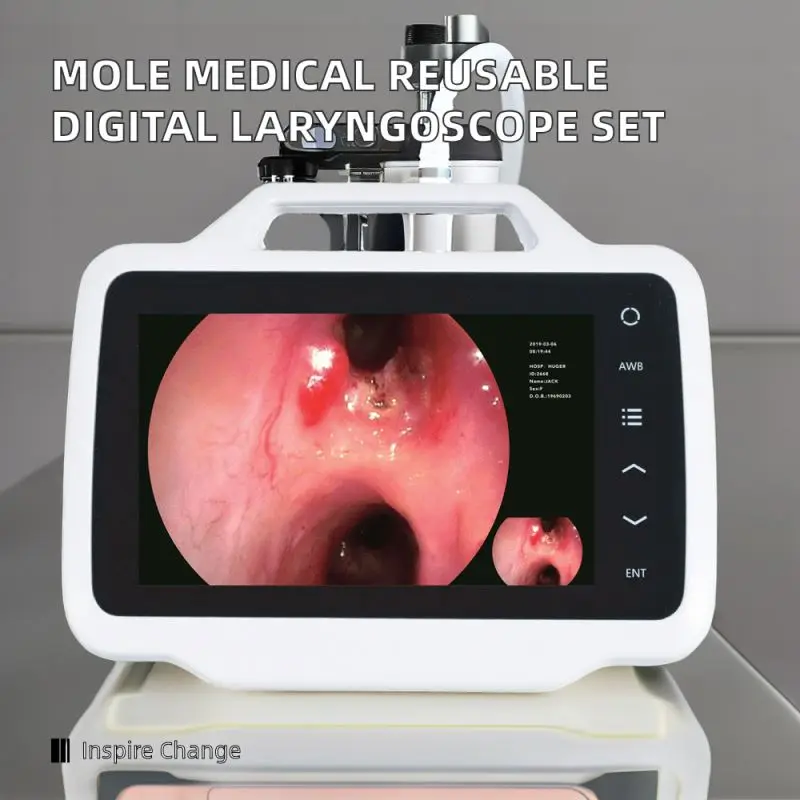 Mole Medical Reusable Digital Video Laryngoscope Set Flexible LED USB Connected Laringoscopio Retractor Electric Power Source