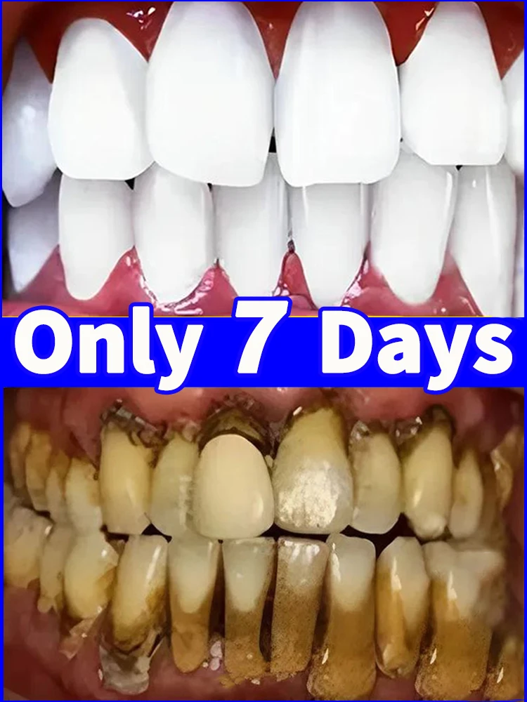 

2025 new tartar removers dissolve tartar and remove stains 100% natural