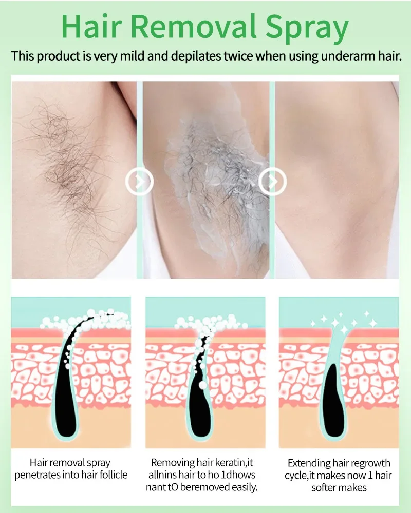 2 분 빠른 제모 스프레이, 무통 모발 성장 억제제, 팔 겨드랑이 다리 영구 제모제, 남성 여성 수리 케어