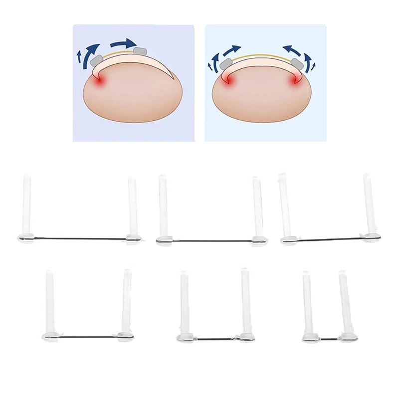 Ingrown Toenail Correction Wire Foot Care Tools Professional Treatment Recover Embed Toe Nail Pedicure Straightening Toe Tools