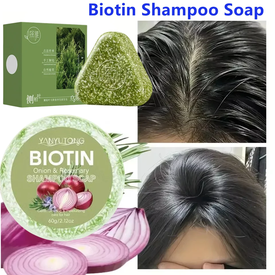 

Onion Extract Biotin Shampoo Soap Natural Dandruff Fighting Formula with Oil Control Moisturizing Scalp Care Healthy Hair Care