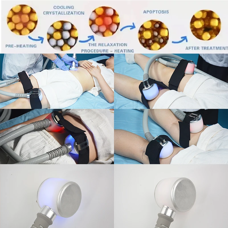 NEW Cryo Freezing Slimming 4 in 1 Thermal Freezing Star T-Shock Body slim Cryotherapy Machine