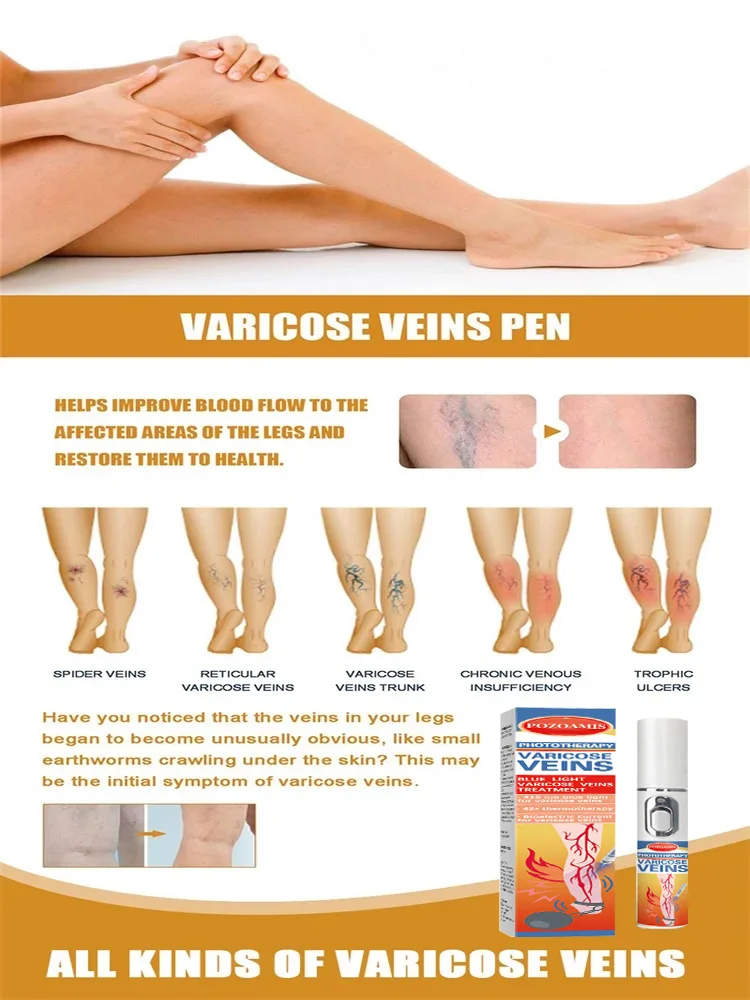 ᵇˡᵘᵉ ˡⁱᵍʰᵗ ᵖᵉⁿ ˢᵒˡᵛᵉ ᵛᵃʳⁱᶜᵒˢᵉ ᵛᵉⁱⁿˢ⸴ ʰᵒᵗ ˢᵃˡᵉ ˡᵉᵍ ᶜᵃʳᵉ ᵗᵒᵒˡˢ