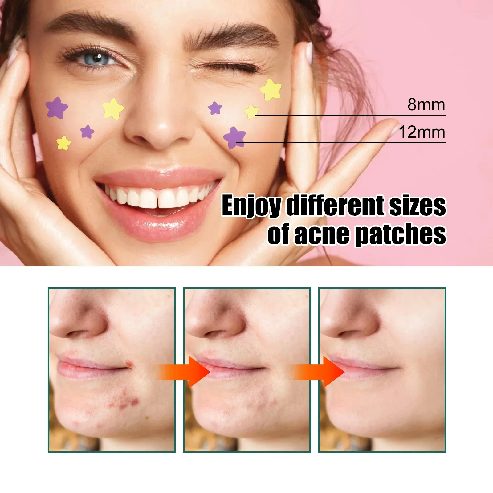 1/2/3 Box Star Acne Patches Invisible Pimple Cover Face Oil Control Spot Treatment Cute Sticker for Covering Zits and Blemishes