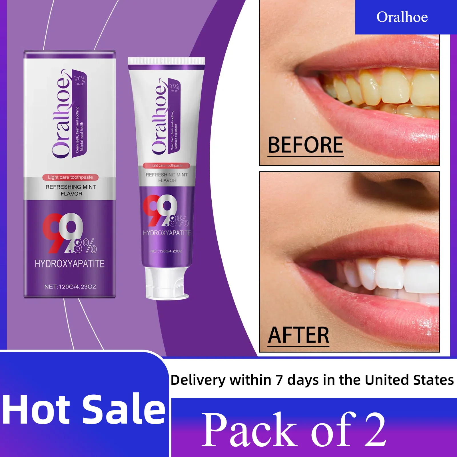 2pcs Anti-yellow Toothpaste Removes Smoke Stains, Freshens Breath, Effectively Brightens and Protects Tooth Enamel Oral Care