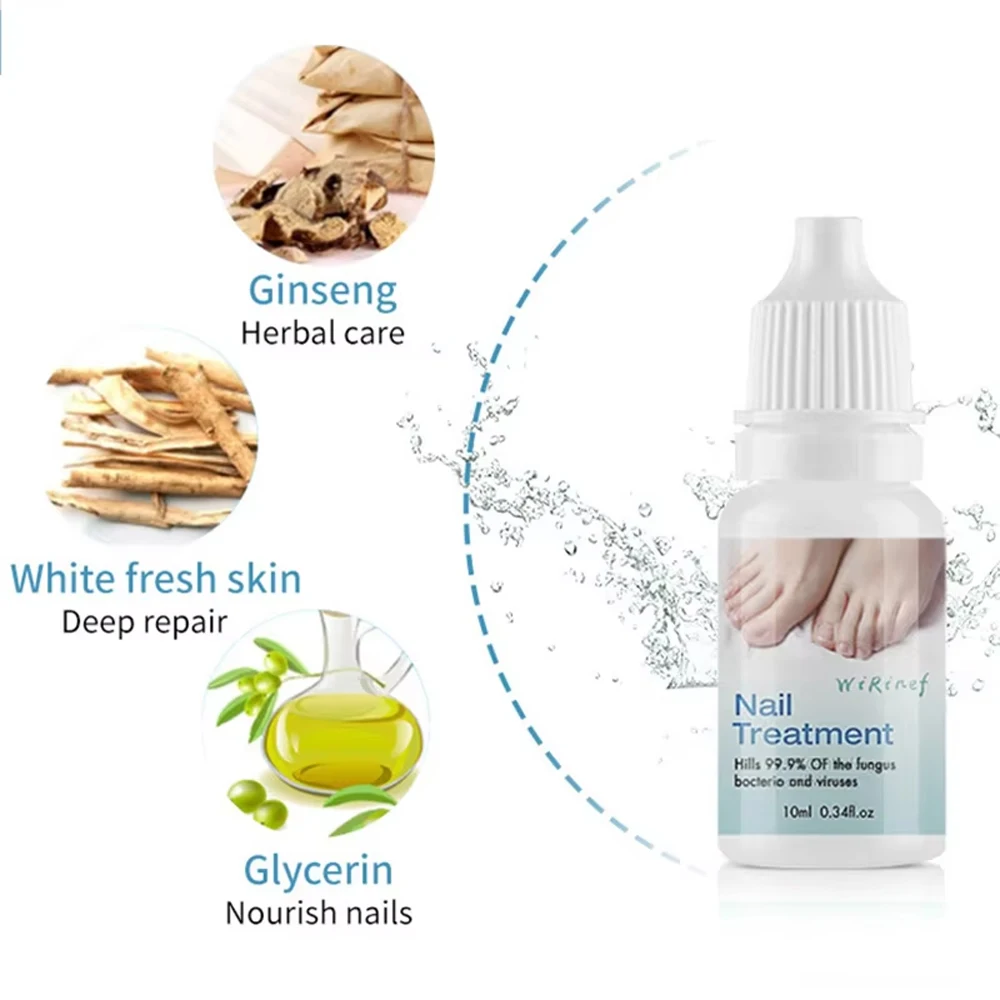 Nail Fungus Treatment Serum Toe Nail Fungus Removal Essence Anti Infection Paronychia Onychomycosis Hand Foot Nail Care Cream