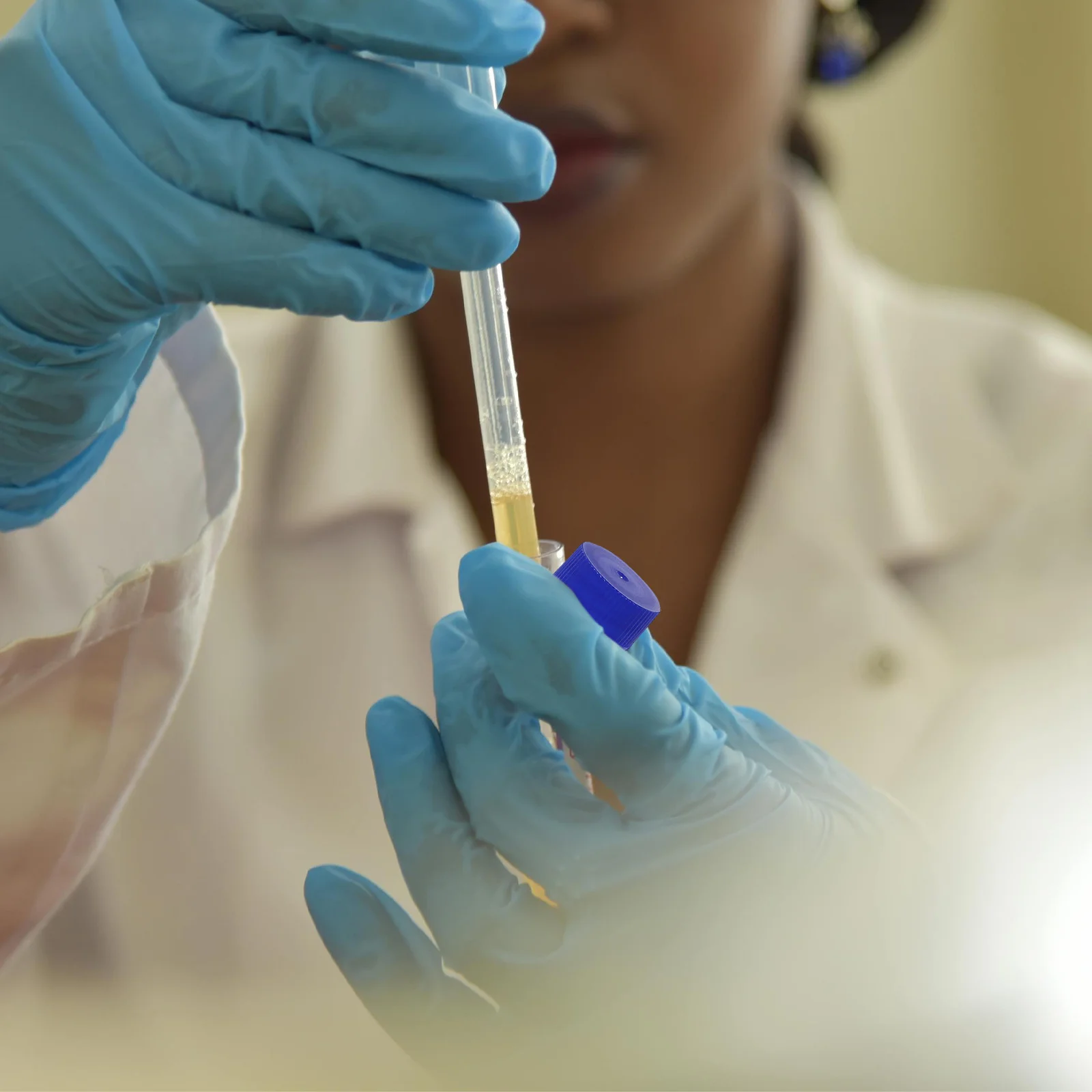 

200 Pcs Sediment Test Tube Plastic Sample Collection for Urine Tests Cups Container