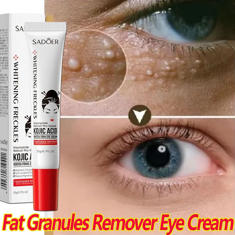 ไขมันเม็ดRemoverครีมบํารุงรอบดวงตาปรับปรุงEye Bag Fade Fine Lines Dark Circle Moisturizing Anti-Puffiness Lifting Firming Eye Care