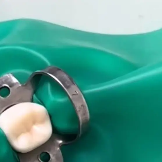 

5Pcs/Set Dental Rubber Dam Clamps Stainless Steel Endodontic Restorative Barrier Clips Dentistry Accessory 50Size