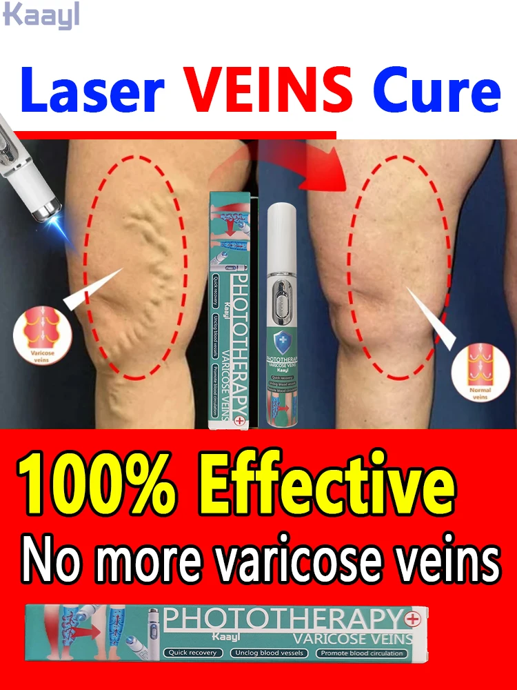 

Vein Laser - Hot Selling