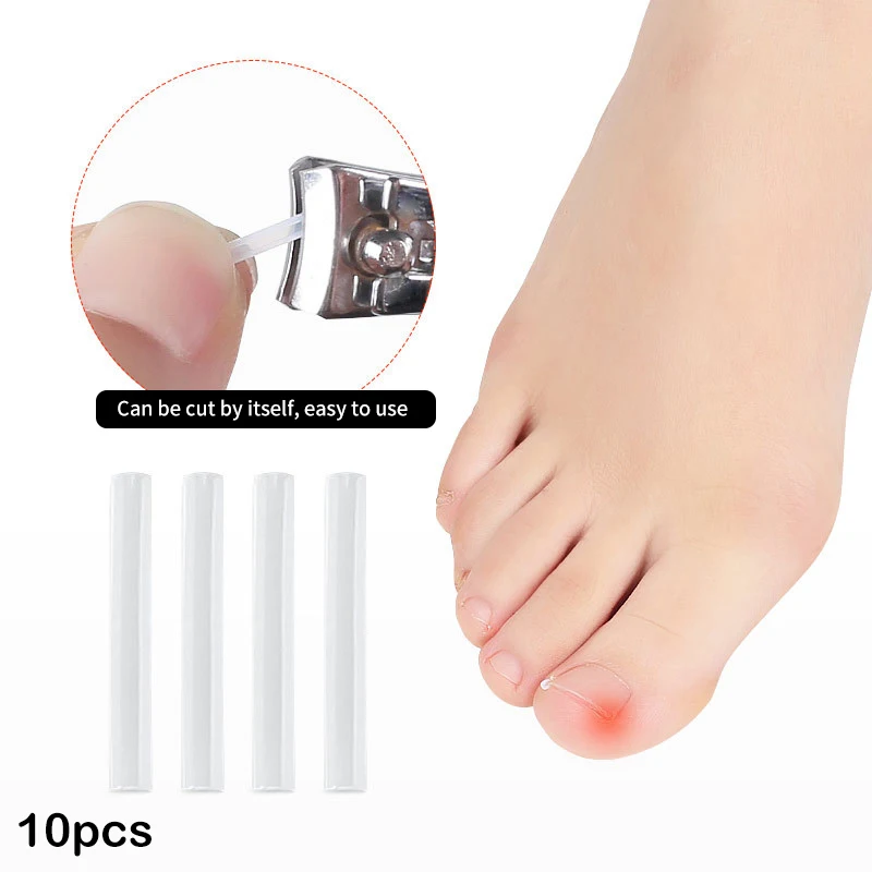 10Pcs Ingrown Toenail Correction Tool Ingrown Toe Nail Treatment Elastic Patch Sticker Straightening Clip Brace Pedicure Tool