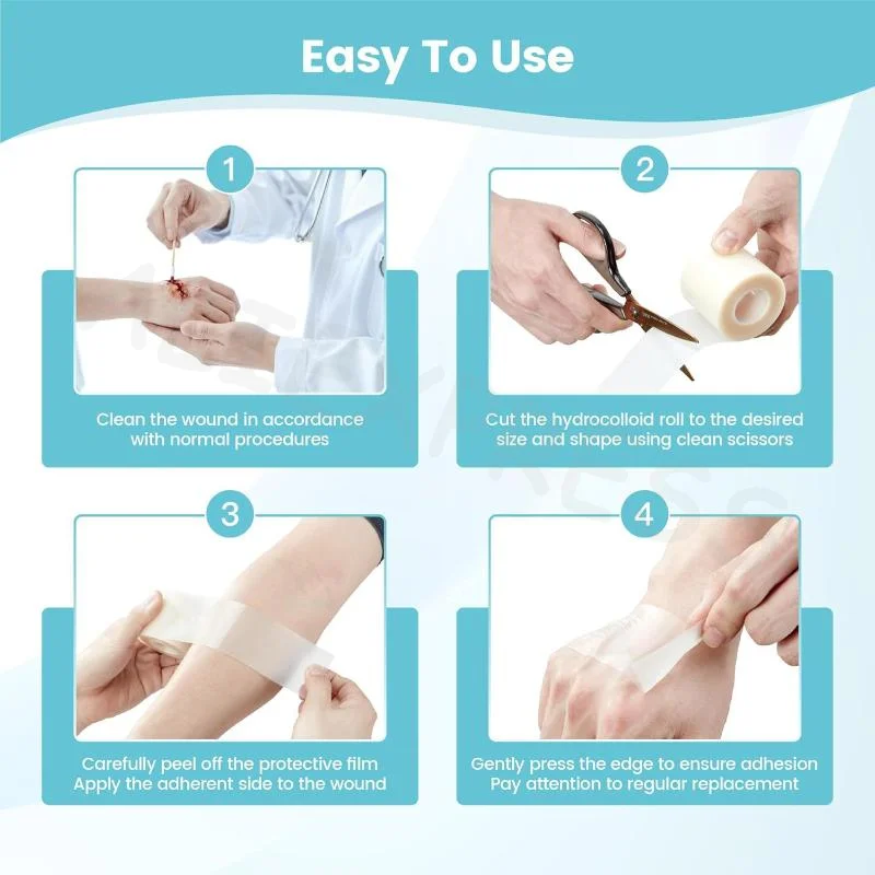Rol Perawatan Luka Hidrokoloid - Bandage ulasan dan harga