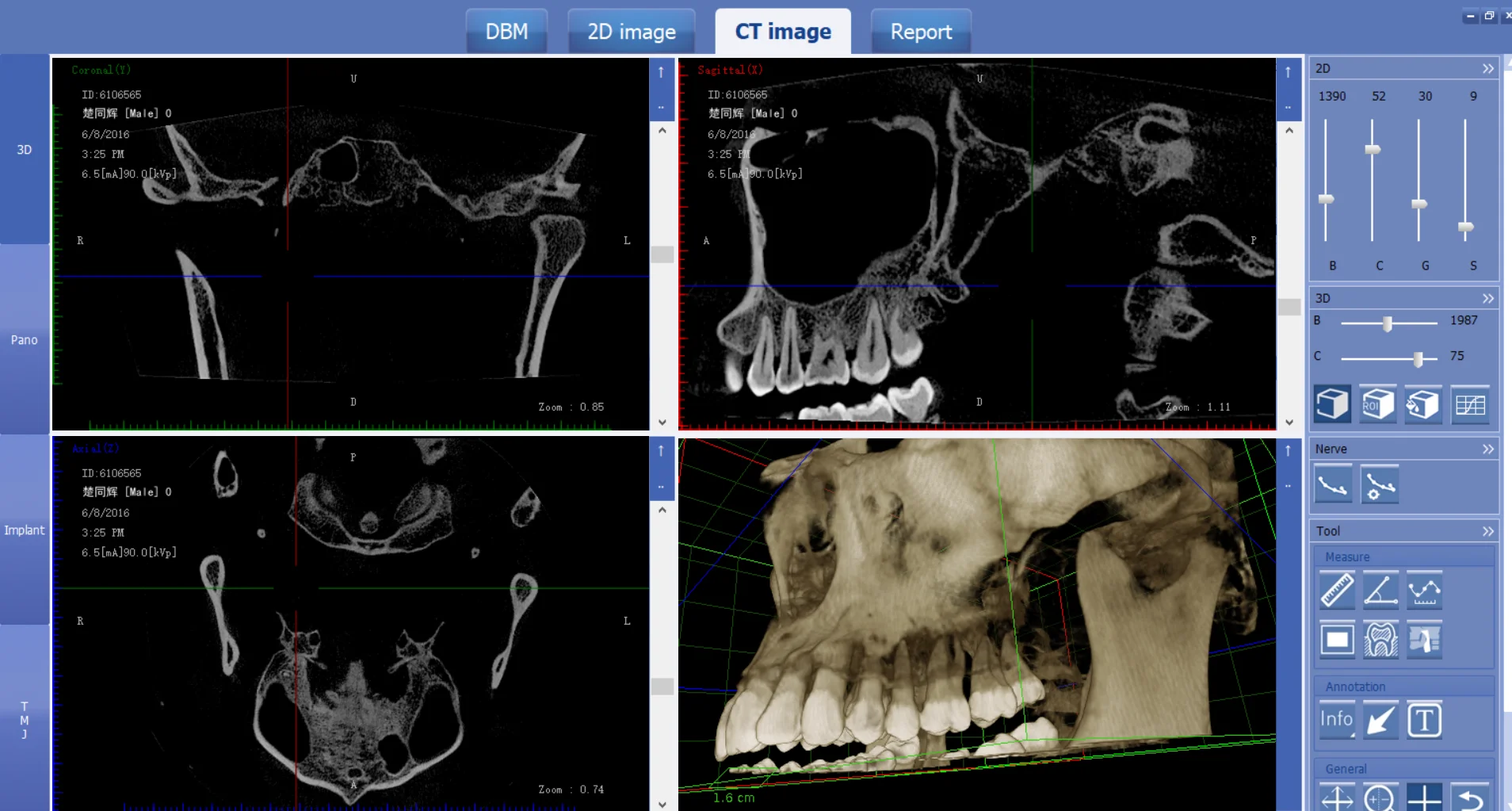 Newest cbct den  tal x ray machine equipments