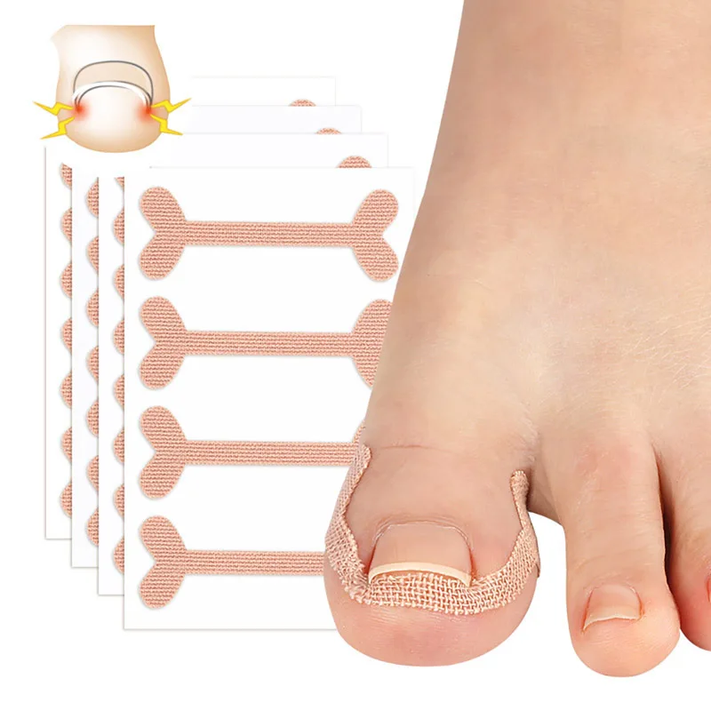 Improve Toe Embedded Nail Groove Relief Paste And Correct Nail Curling