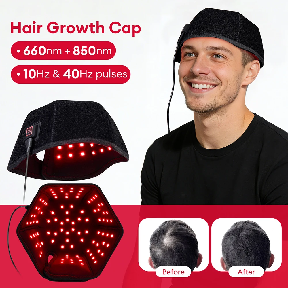 

Шапка для роста волос с 300 ИК-светодиодами: терапия красным светом, улучшение состояния волос, предотвращение выпадения, улучшение качества сна