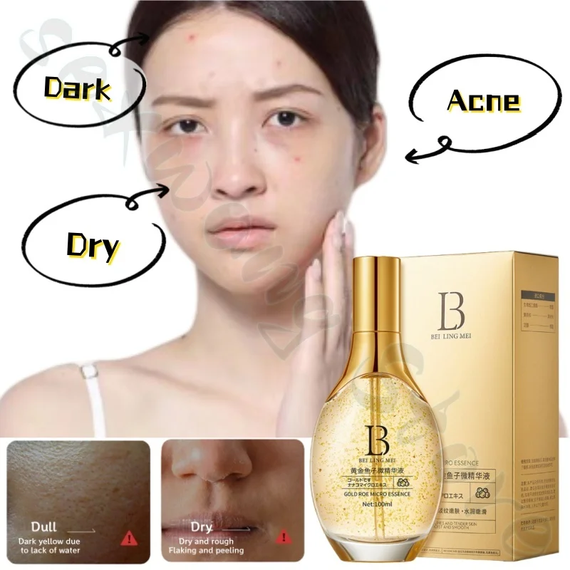 Gold Caviar Micro Essence Small Molecule Hydrating Brightening Skin Tightening Skin Diminishing Fine Lines Essence 100ml