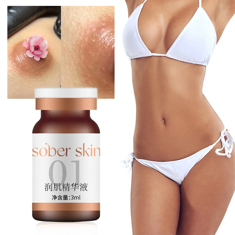 SOBER SKIN 여성용 프라이빗 파트 케어 세트 5PCS 화이트닝 겨드랑이/무릎 에센스 리퀴드 라이트닝 프라이빗 파트 스킨 뷰티