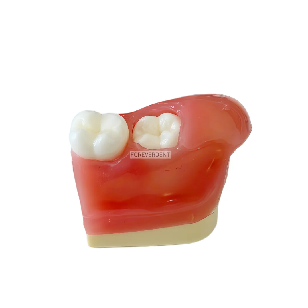 Picture 7: M8026 Impacted Wisdom Tooth Extraction Training Model Dental Tooth Model Oral Teaching Replaceable Base