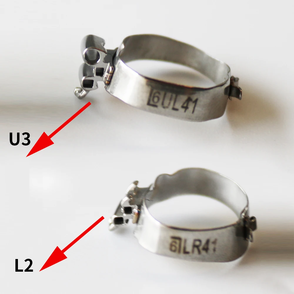 DZK Dental U3L2 Molar Band MBT 022 Convertible Buccal Tube With Cleat (33-41) (Upper triple Lower double)