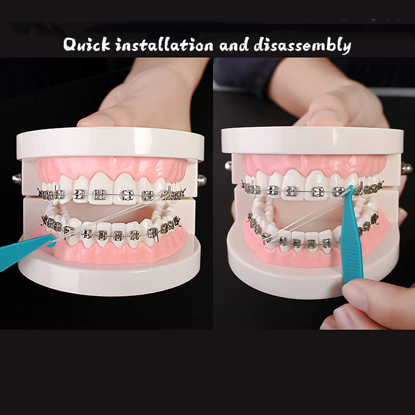 100 Pcs Orthodontic Elastic Rubber Bands, 3.5 Ounces Heavy Dental Rubber Traction Bands, Free Elastic Placer for Braces