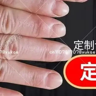 Silicone Finger Prosthetic Thumb Gloves for Disabled People Artificial Hand Protection Covers Large Thumb Simulation Gloves