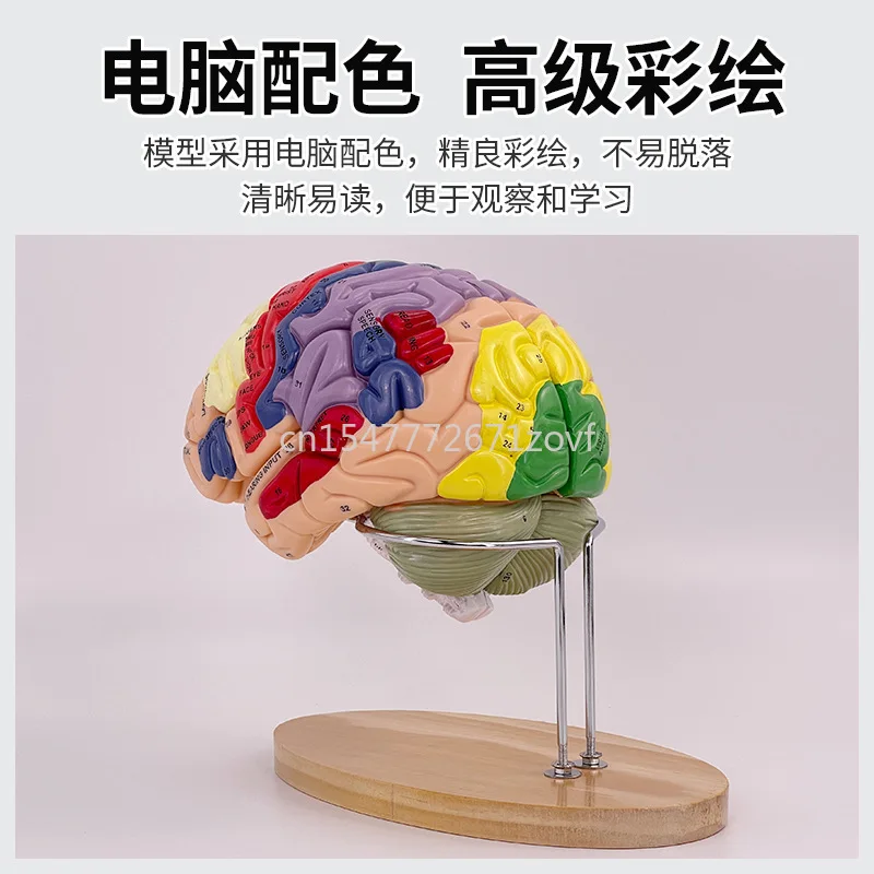 2 Times Magnification 4 Parts Brain Attached Cerebral Artery Model Cerebrovascular Model Neurology Human Brain Anatomy Model