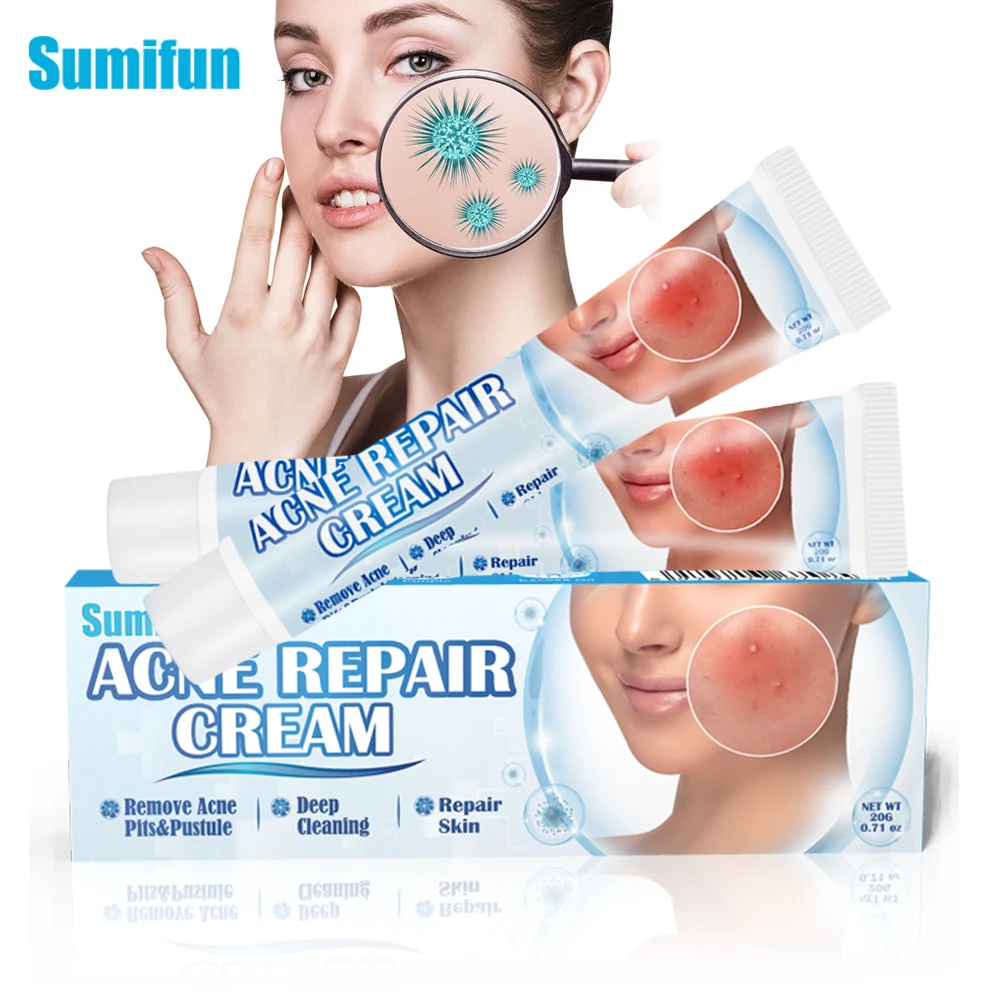 

20G Acne Relief Cream Face Cleansing Pimple Pits Pustule Treatment Antibacterial Ointment Herbal Moisturize Gel Facial Skin Care