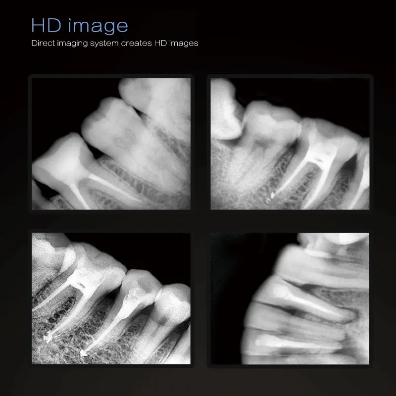 Portable smallest denta x-ray RVG sensor detector machine