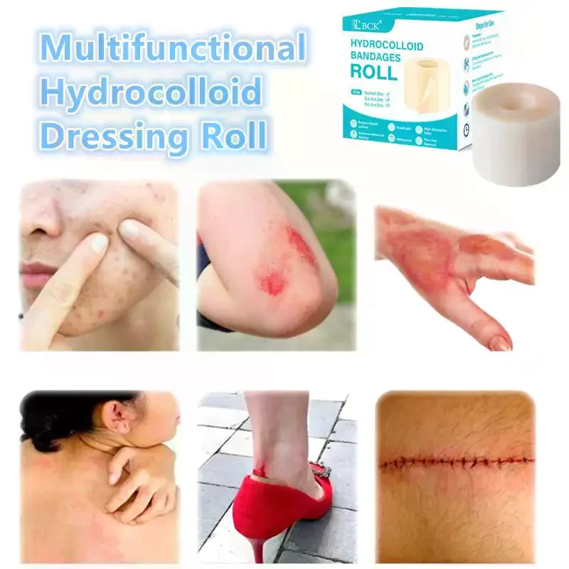 Hydrocolloid Roll For Wound Care Hydrocolloid Patch Bandages With Self-Adhesive Bed Sore Bandages Highly Absorbent For Burn