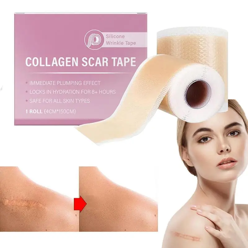 1 Roll Silicone Scar Sheets, 4cm X 150cm Self-Adhesive Scar Cover Tape Reusable and Effective Skin Care Strips Collagen Scar Tap image 3