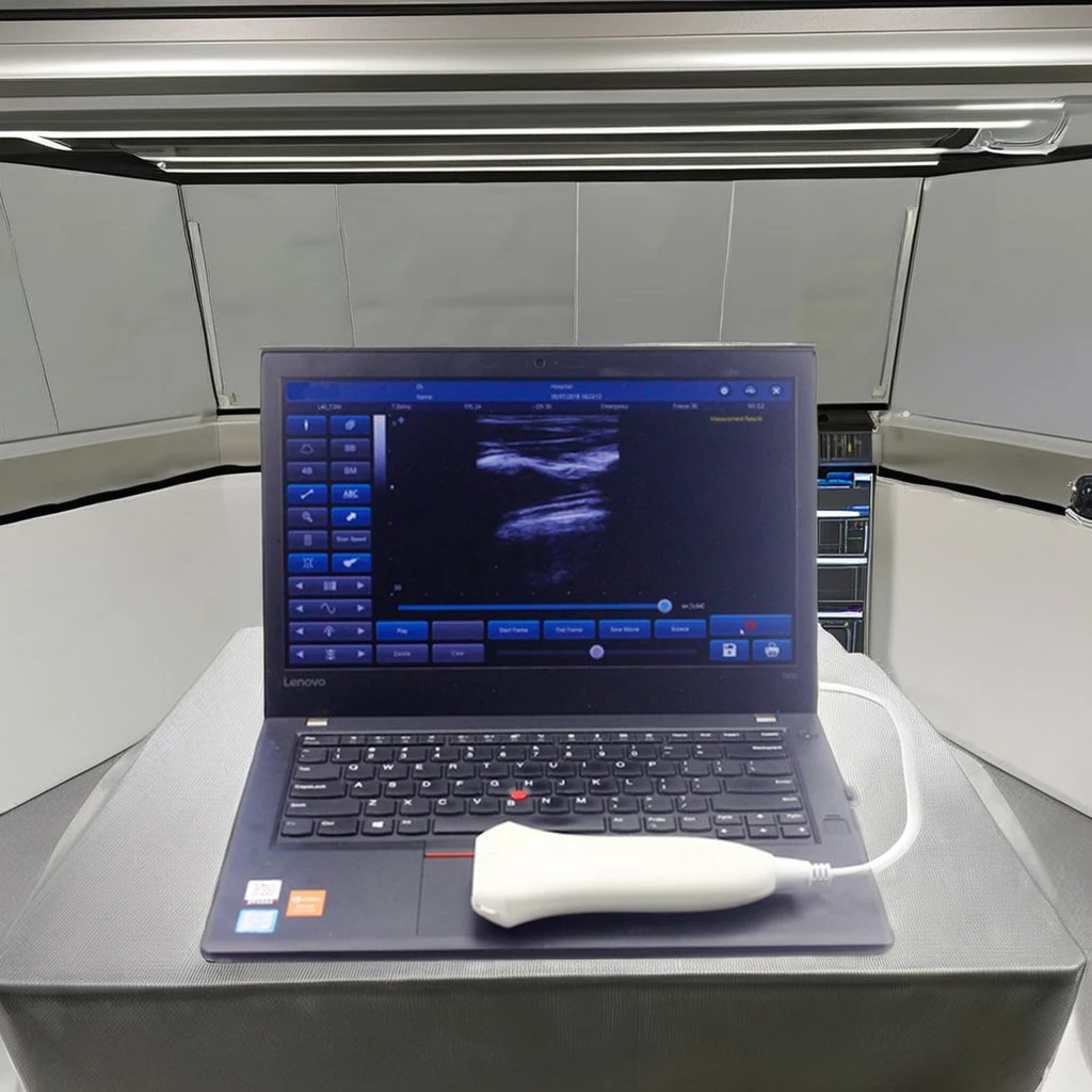 Wholesale Custom Portable Linear Ultrasound Probe Ultrasound Probe Wireless With Laptop Interface USB Electric Power Source