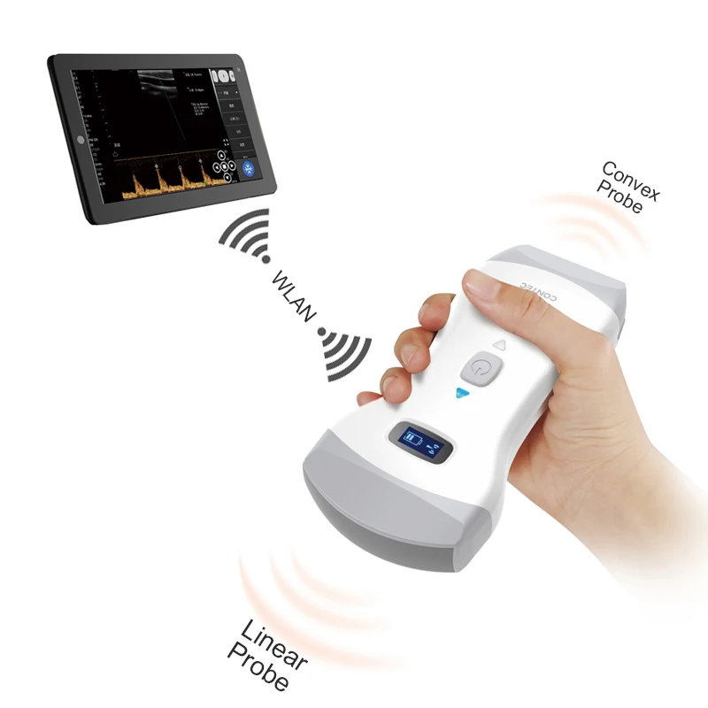 CONTEC Handheld Color Doppler Ultrasound Diagnostic Machine CMS1600B Convex /Linear Dual Probe Wireless Charing WIFI Transmssi