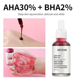 AHA 30% + 2% BHA siero viso esfoliante soluzione Peeling superficie esfoliante pelle schiarire prodotto per la cura della pelle 30ml