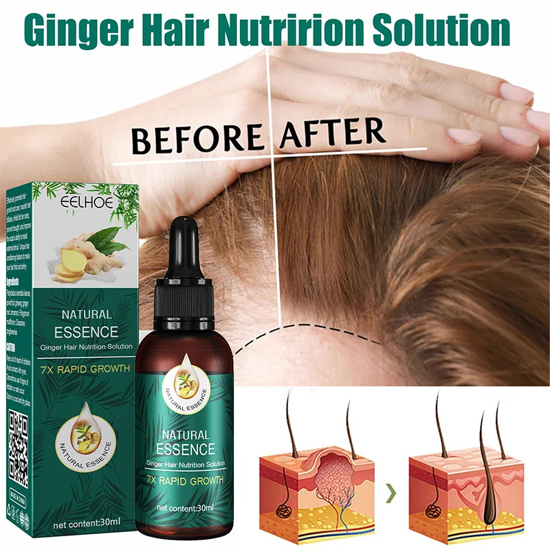 30ml Hair Fast Growth  Natural Ginger Hair Growth Product And Hair Care Essence And Hair Growth Oil  Improve Scalp Environment