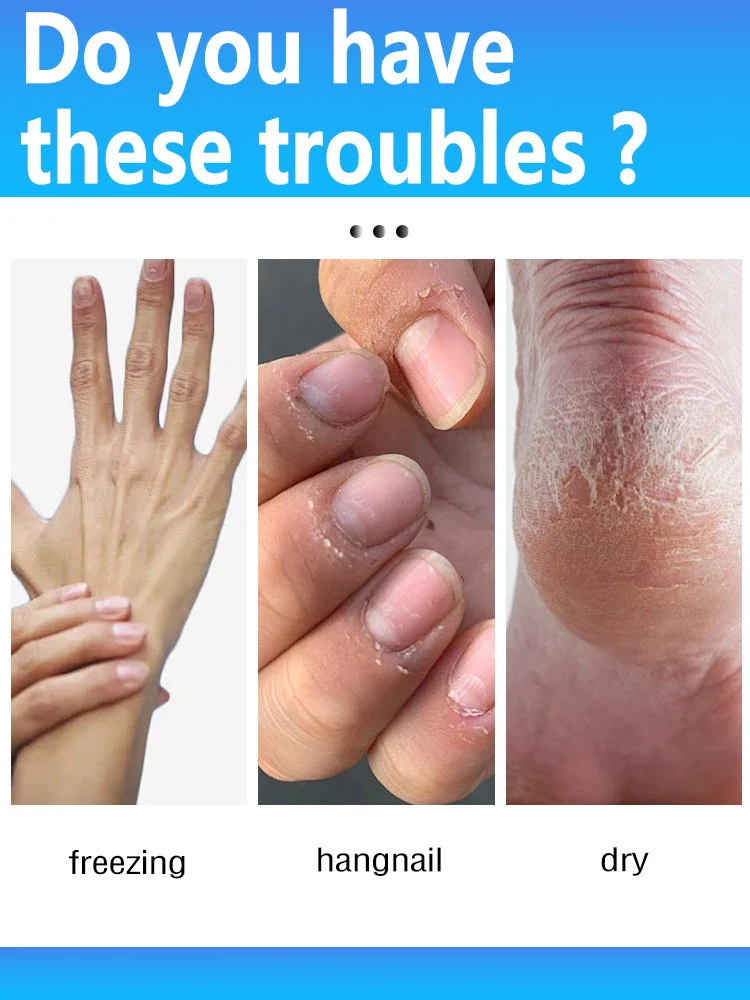 乾燥を防ぐ女性用クリスマスギフトセット。 ひび割れたかかとを防ぎ、ワセリン配合、長時間保湿 - 35g