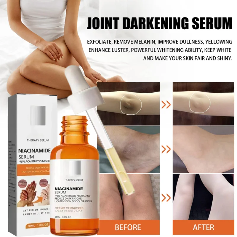 Suero blanqueador de nudillos oscuros, suero de playa para axilas y codos, parte privada de mujer, aclara la piel de las nudillos oscuros, suero blanqueador fuerte
