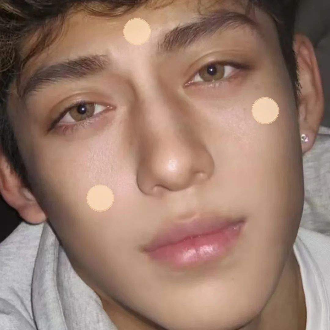 رقع حب الشباب الغروانية المائية غير المرئية - ملصقات العيب والبثور، تثبيت سريع للدراسات، بشرة مهدئة ومهدئة، لطيفة وسهلة #3