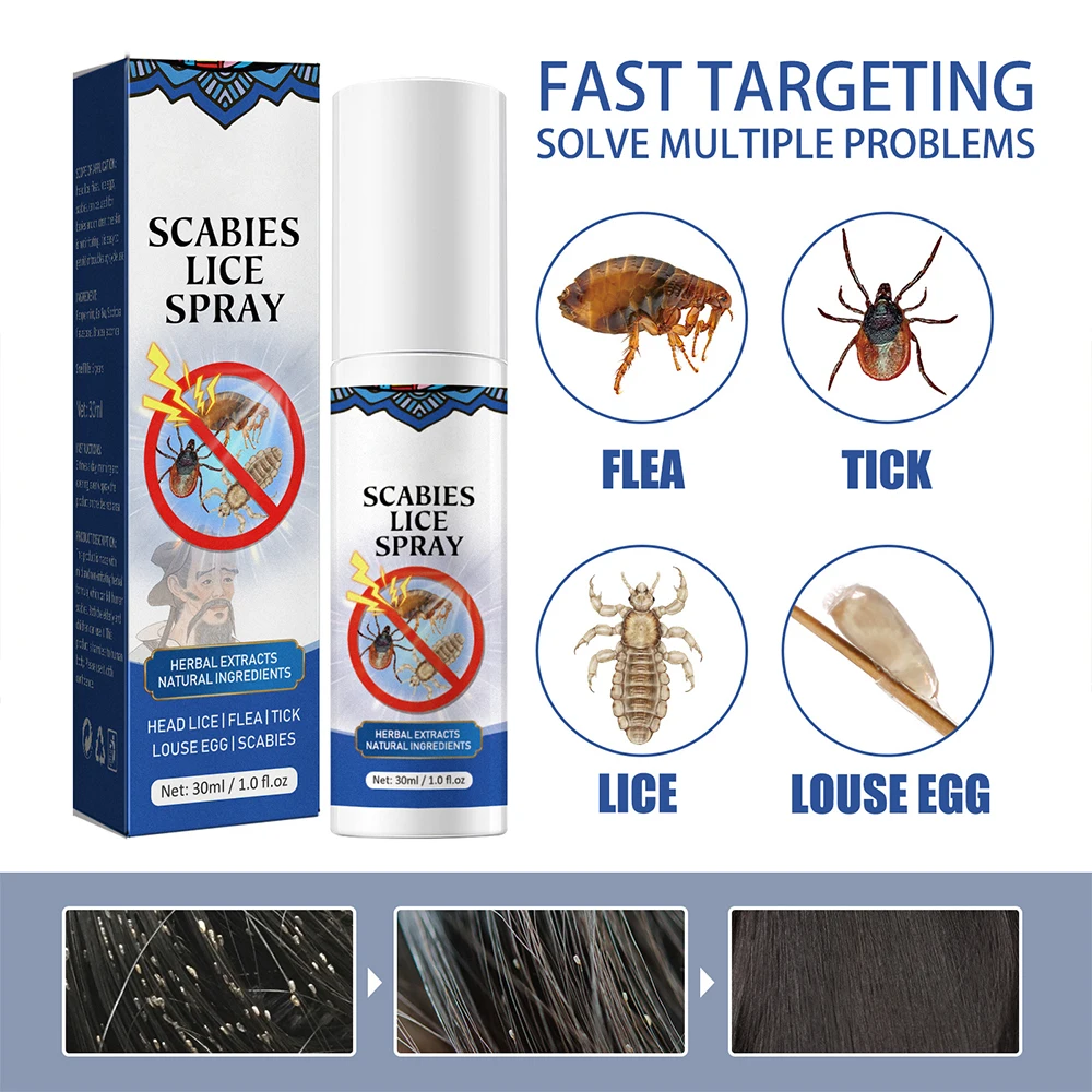 30ml Head Lice Removal Spray Children Adults Preventative Removal For Lice Eggs Nits Promotes Lice-Free Hair Get Rid Of Fleas