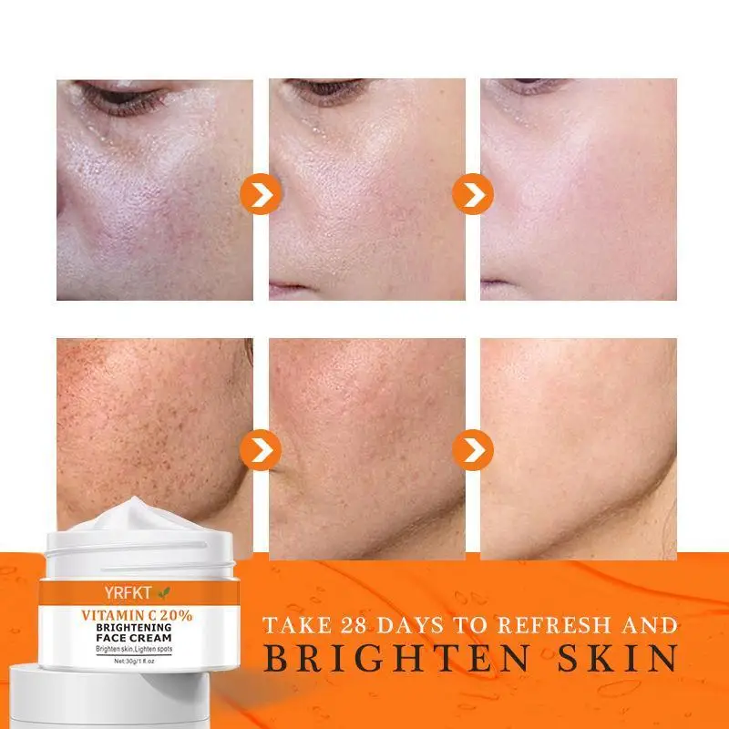 

Powerful Skin Whitening Cream Remove Freckles And Dark Spots VC Whitening Cream