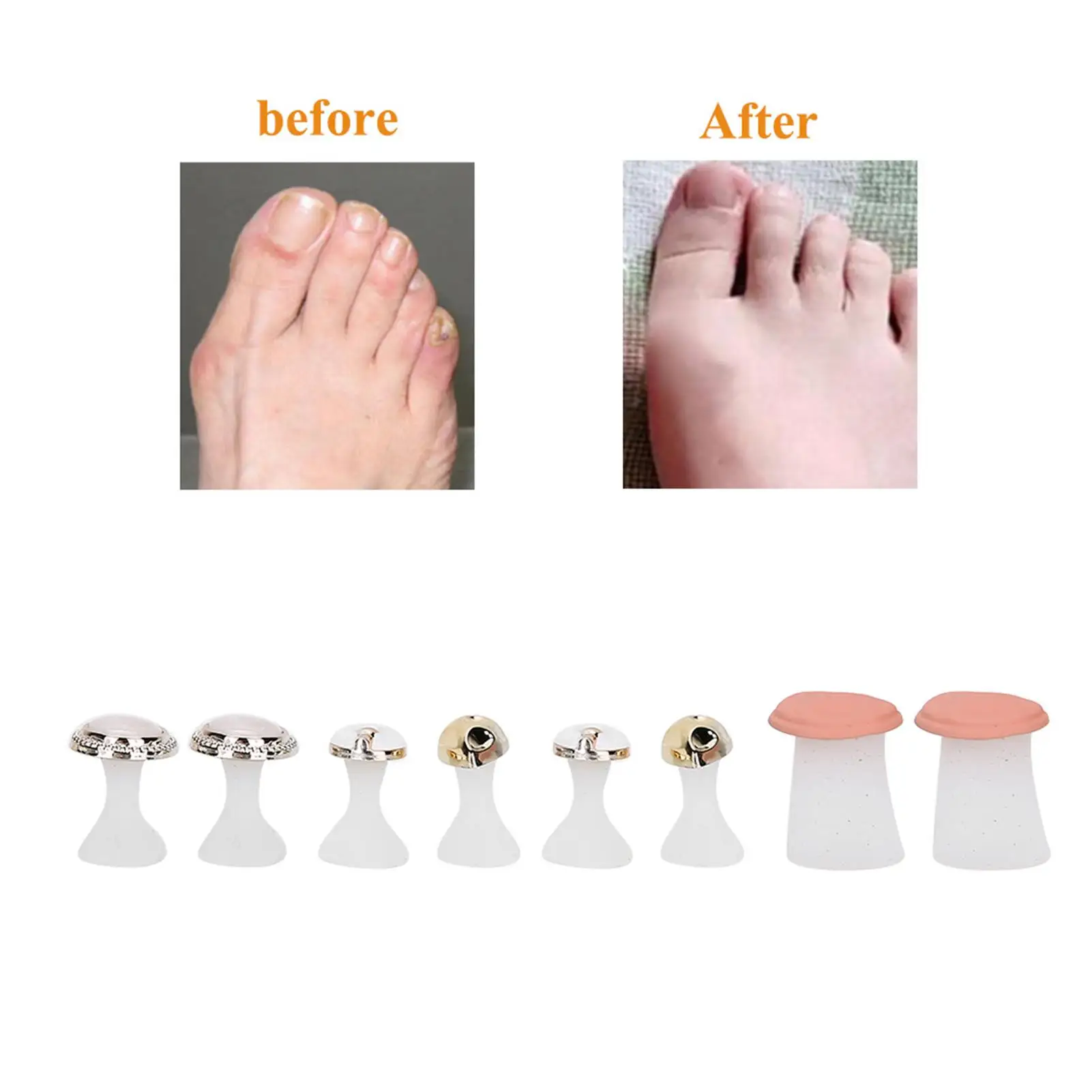 발 관리용 부드러운 실리콘 발가락 분리기 네일 아트 도구 꽃 홀더 매니큐어 페디큐어 액세서리 8개 세트