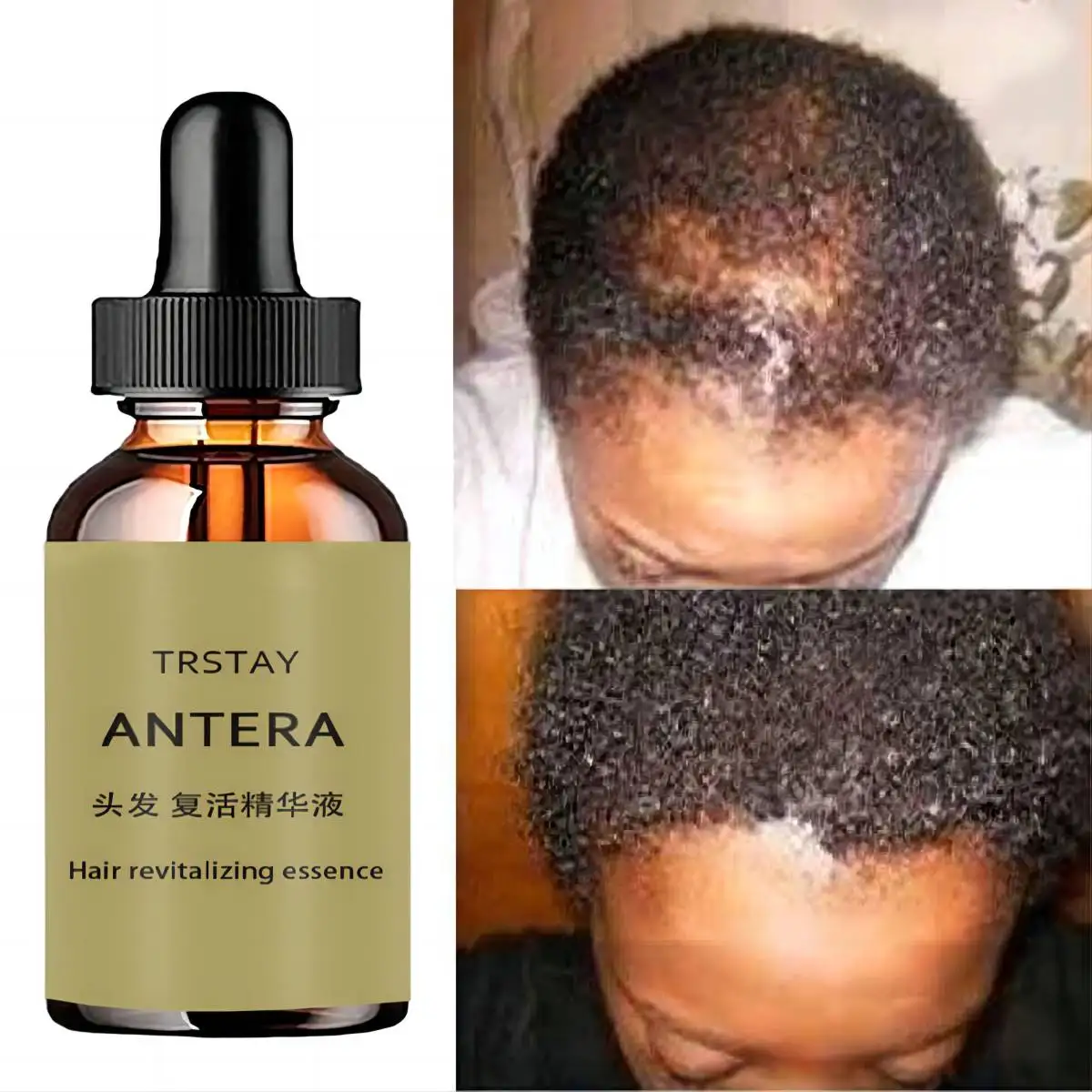 Magical Hair Growth Oil for Black Women Regrowth Serum Hair Loss Men Hairloss Kids Hairless Infused Black Castor Oil 2022 New