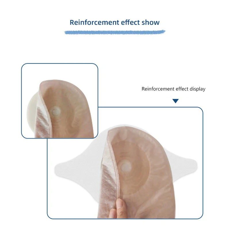 Ostomy Barrier Strips Y Shape Hydrocolloid Adhesive Seal Extender Strip For Colostomy Bags Ileostomy Tape For Stoma Ostomy Bag