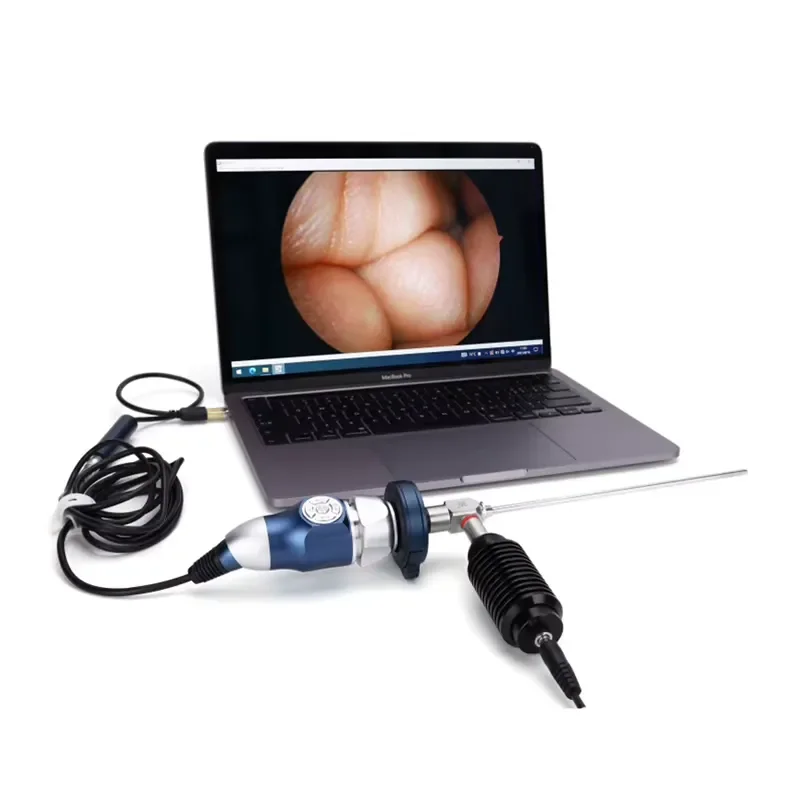 Camjoy 1080P Portable USB Endoscope Camera System for ENT and Veterinary Clinics — Full HD CMOS Imaging