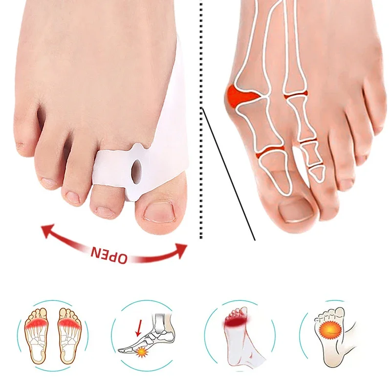 مصحح أروح الإبهام، مصحح أروح الإبهام، فاصل أصابع القدم، فاصل السيليكون #3