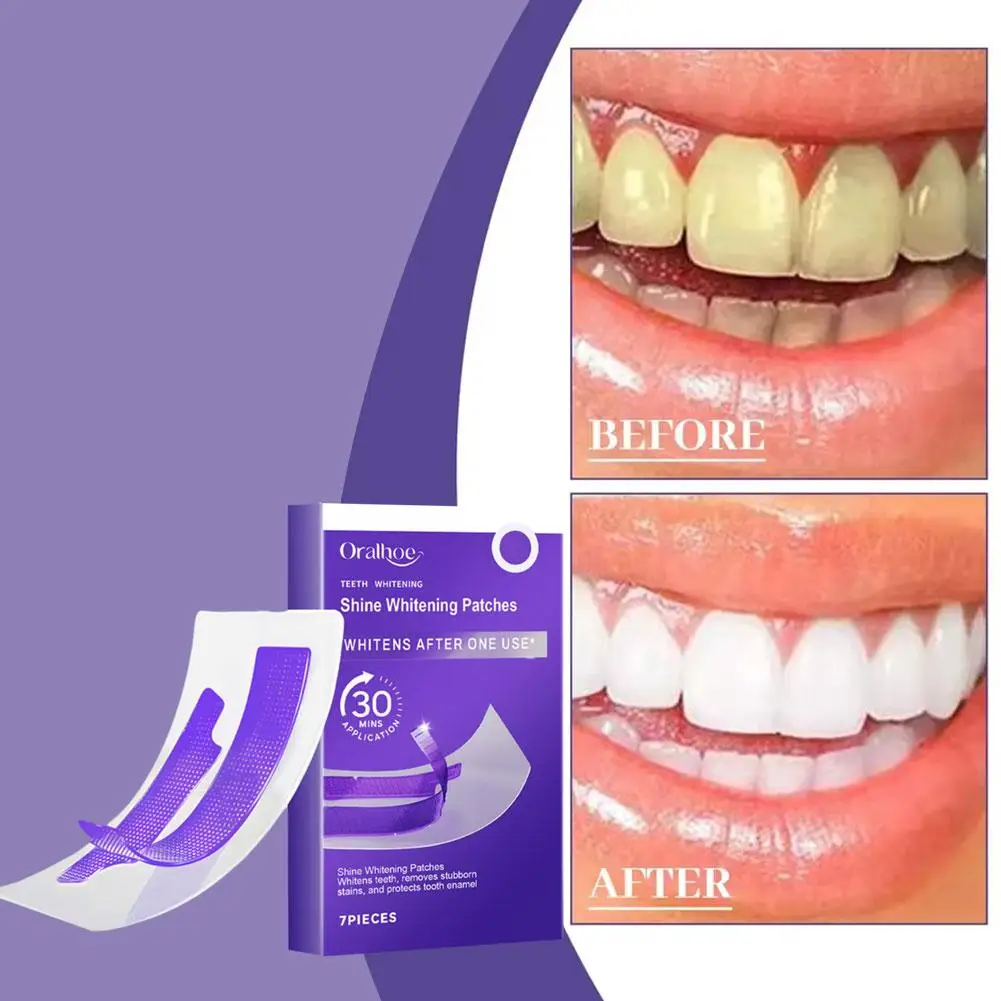 

7pcs Teeth Whitening Strips Gentle Teeth Cleaning Strips Daily Oral Care Fast Brightening Stain Removal Dental Care Kit