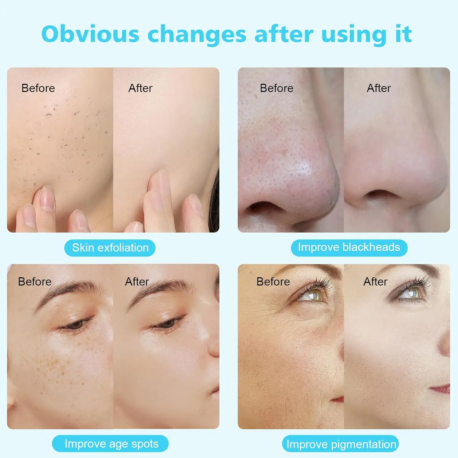 Diamond Micro Crystal Skin Grinder Professional Skin Care And Beauty Instrument Vacuum Scrub Exfoliation Spray Moisturizing