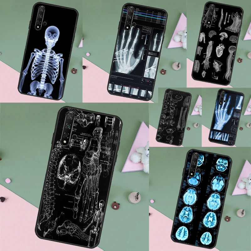 Radiological Human Organs Skeleton Case For Huawei Nova 10 9 SE 5T 7i 8i 11i Y60 Y61 Y70 Y90 P Smart P20 P30 P40 Lite P60 Pro