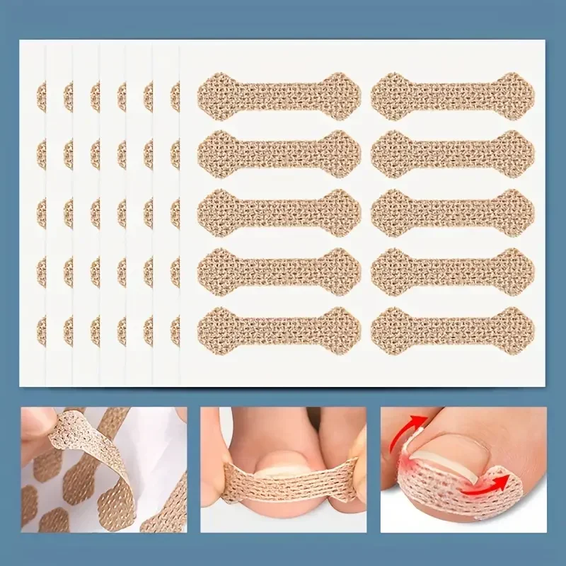 Ensemble de patchs pour orteils, 0 pièces, soulage les ongles incarnés et améliore les soins des ongles avec soutien orthopédique, patch de traction des ongles, orthèses