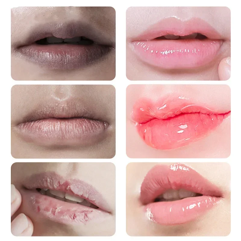 Lippen rosa frische aufhellende Bleich creme Behandlung entfernen dunkle Rauch Lippen Lippen balsam White ning Feuchtigkeit creme pflegende Essenz